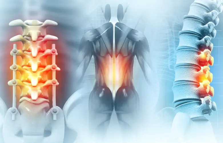 Spine Regenerative Program-CSC RGM