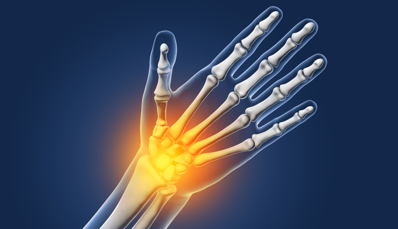 Hand and Wrist Pain Symptoms