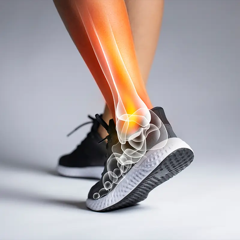 Foot and ankle Pain- CSC RGM